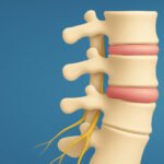 Todo lo que necesitas saber sobre las hernias discales: tipos, síntomas y tratamientos modernos