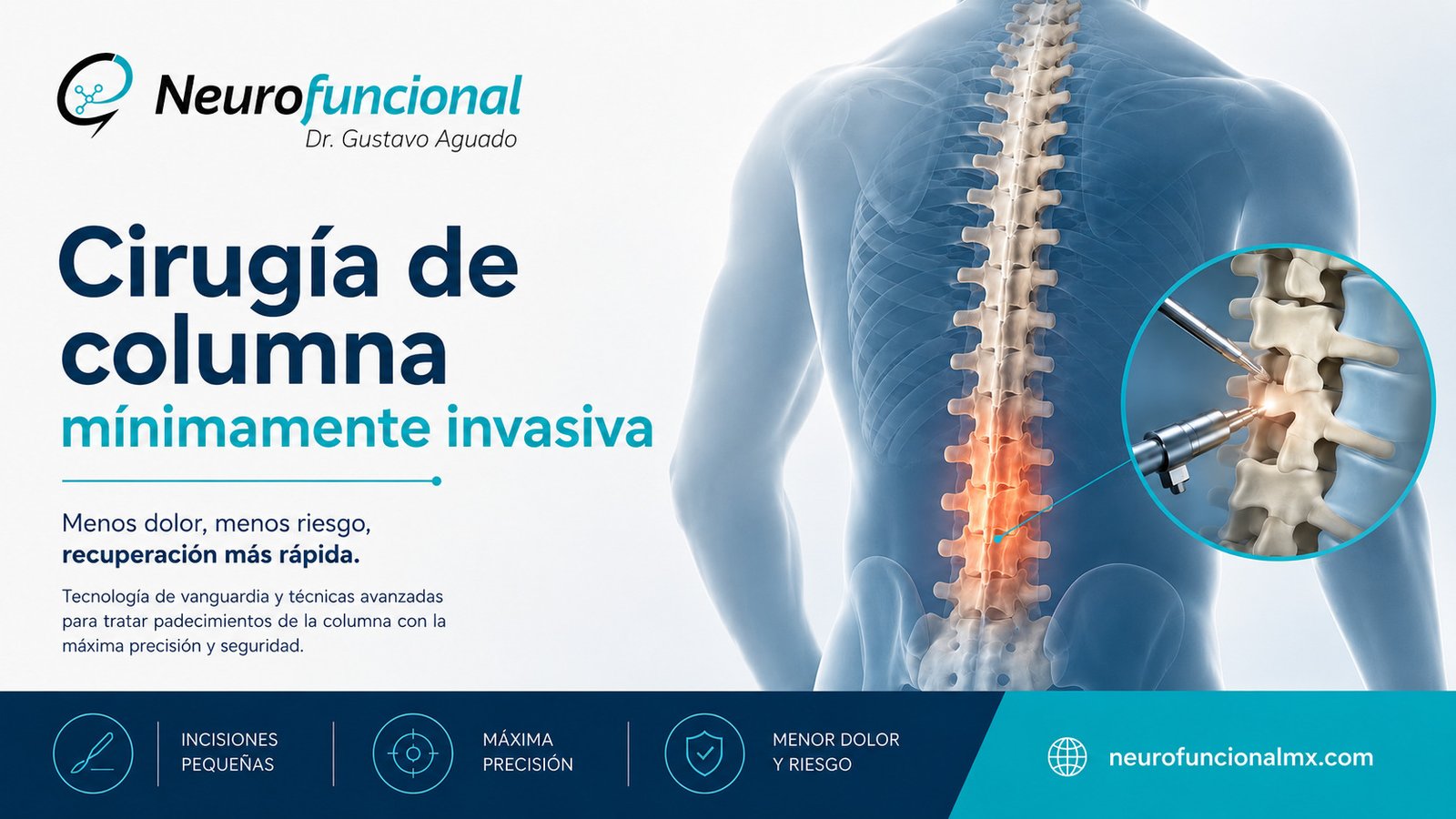 Cirugía de columna mínimamente invasiva para tratar dolor lumbar, hernia discal y compresión nerviosa