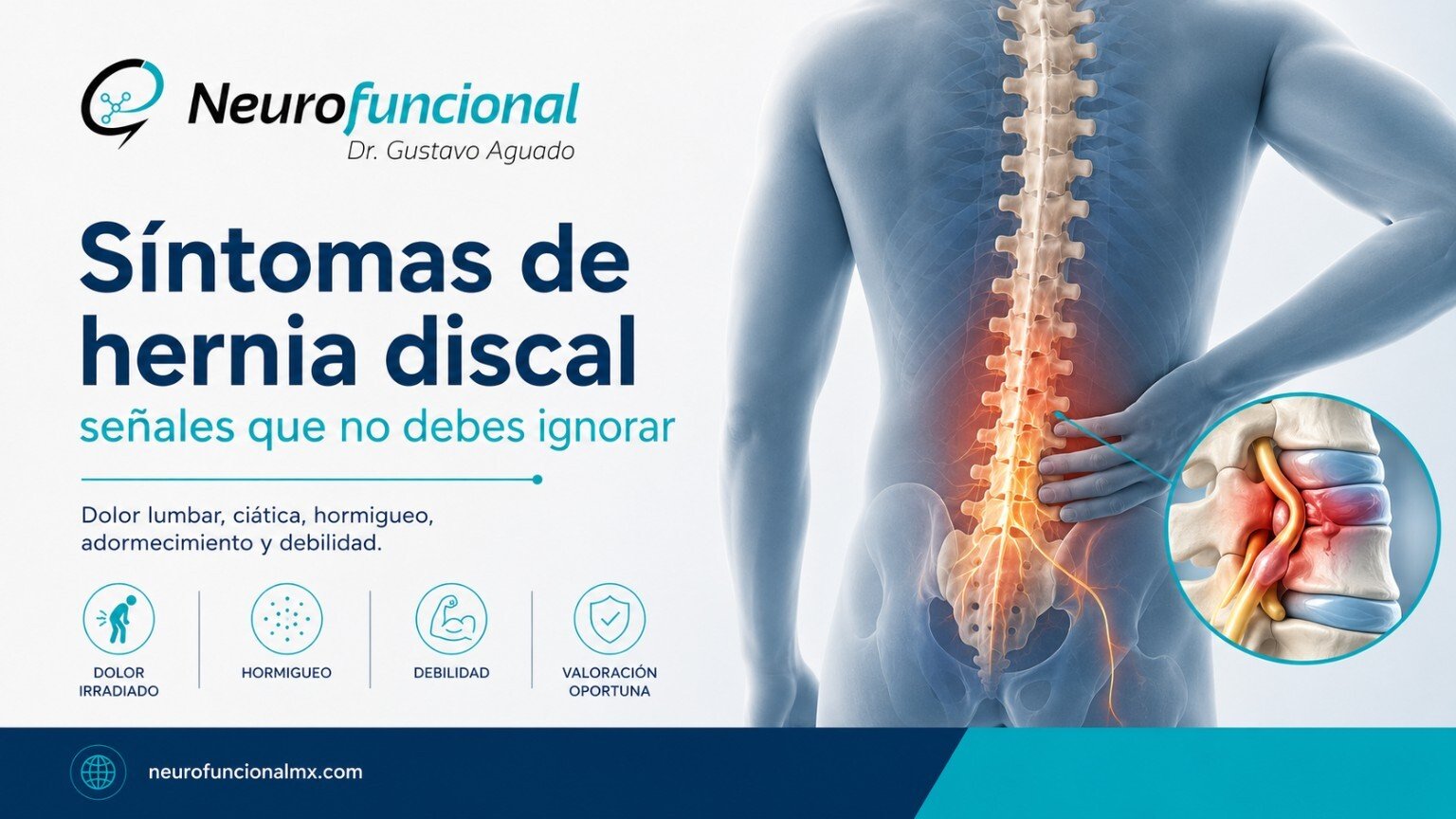 Síntomas de hernia discal como dolor lumbar, ciática, hormigueo, adormecimiento y debilidad