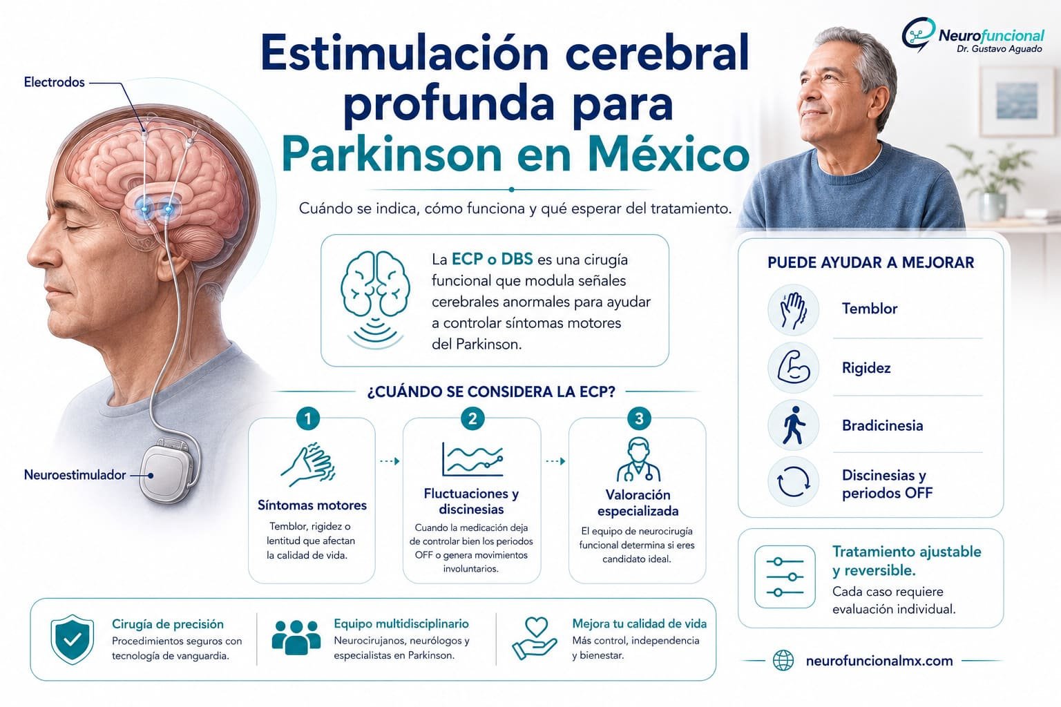 Estimulación cerebral profunda Parkinson México